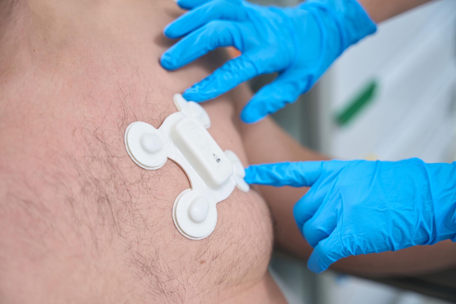 Medical Adhesives